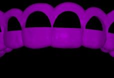Imagem Categoria Guia Periodontal